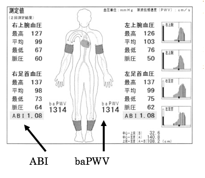 病気のはなし 公立学校共済組合 関東中央病院