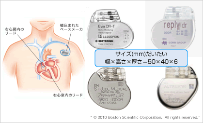 ペースメーカ植え込み術 世田谷 用賀 循環器内科 心臓血管外科 狭心症 心筋梗塞などの検査と治療 ピックアップ診療科 患者様さまへ 公立学校共済組合 関東中央病院