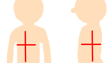 CT撮影時のマーキング例(赤線)