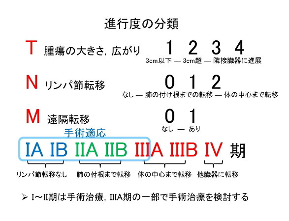 『肺がんと診断されました。』手術できる肺がんとは？