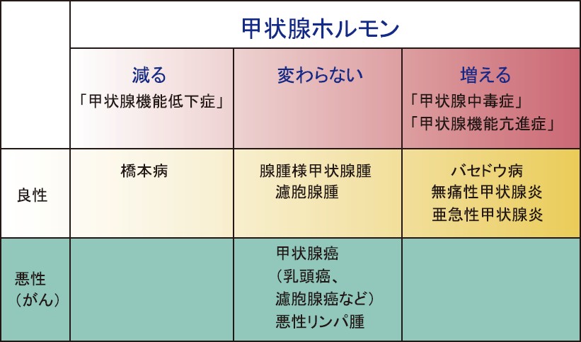 甲状腺の病気の診断