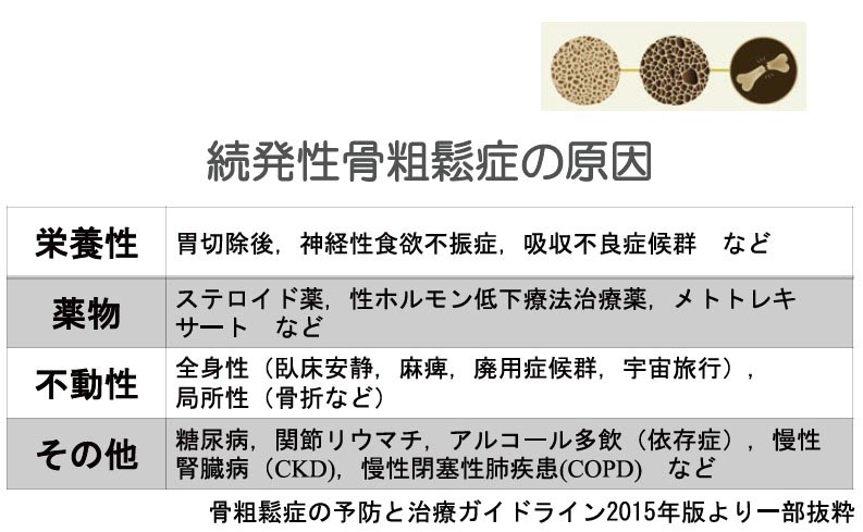 突然の股関節　大腿骨近位部骨折治療と2次骨折予防