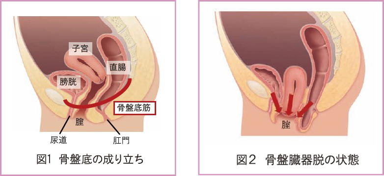 骨盤底筋を鍛えましょう！